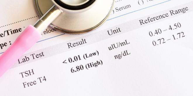 Abnormal thyroid hormone test result.